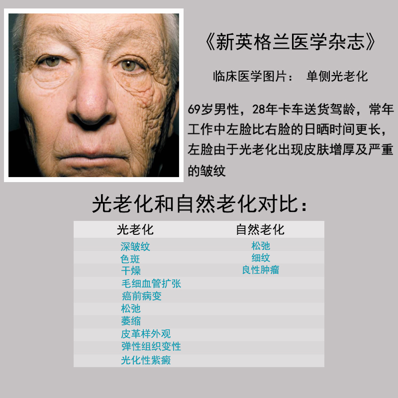 光老化比自然老化更可怕uva是个十足的小恶魔,天阴雨雪天都存在,可