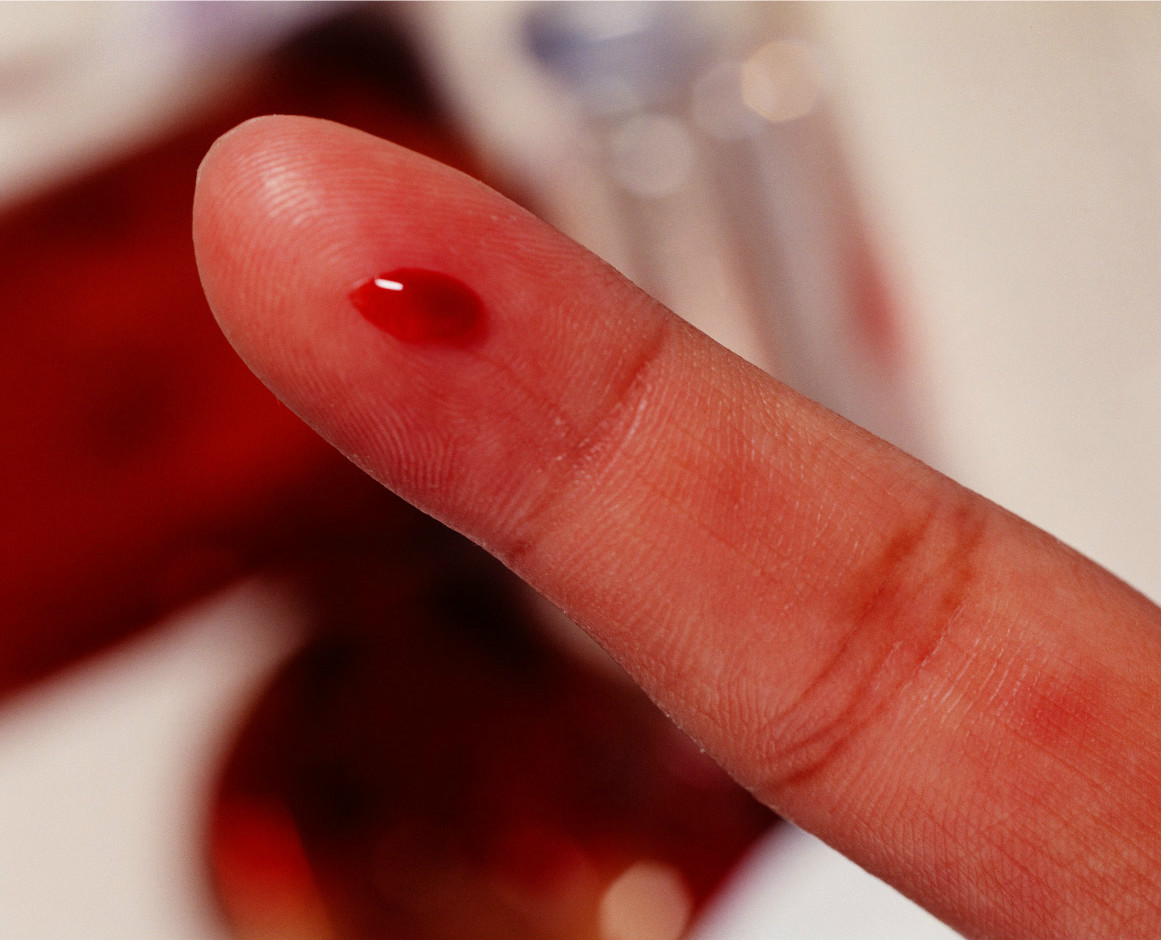 血多音字怎么区分汉字血的正确读音讲解