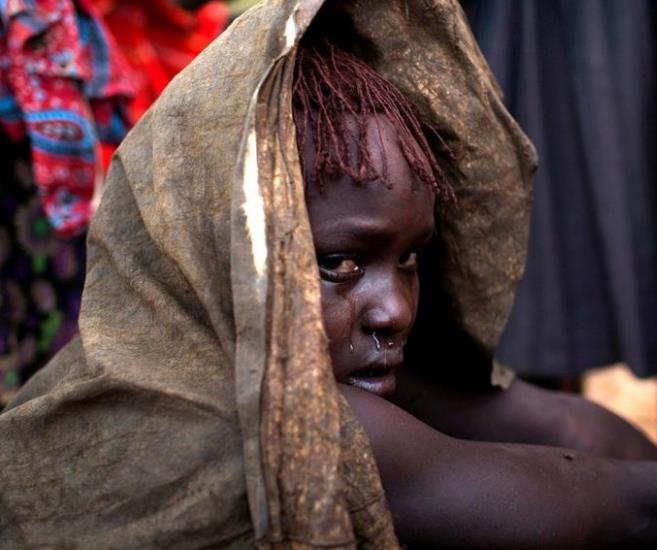 割礼是什么意思 女人的割礼是什么-世界十大百科