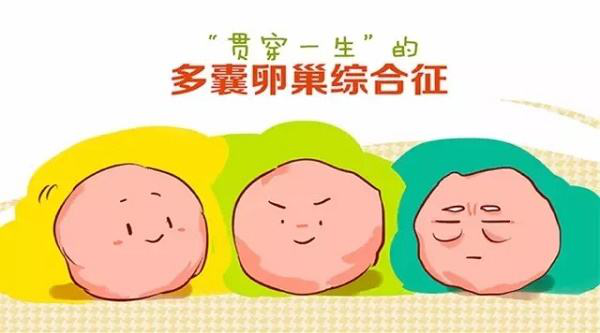如何判断是否为多囊卵巢综合征？