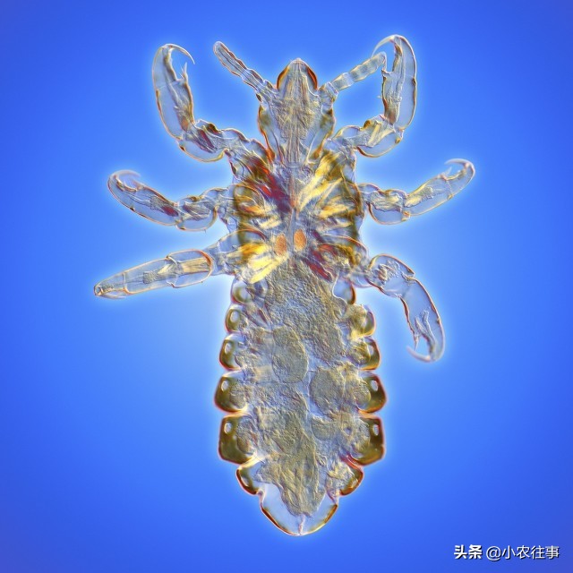 虱子是怎么產生的,