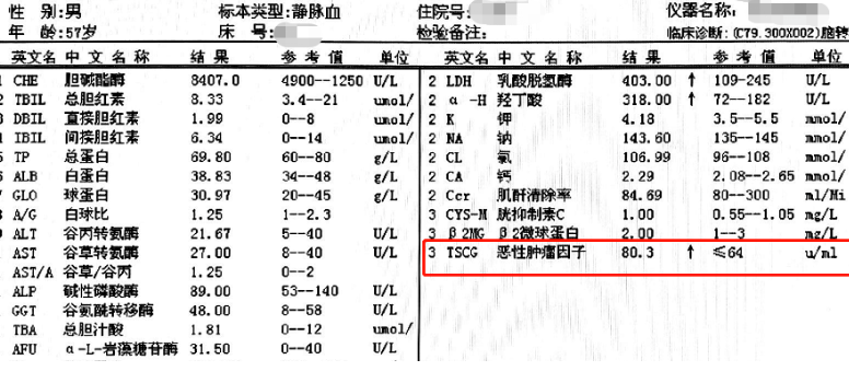 老人查出肠癌，8次化疗2次转移，医生提醒：这些肠癌信号要小心