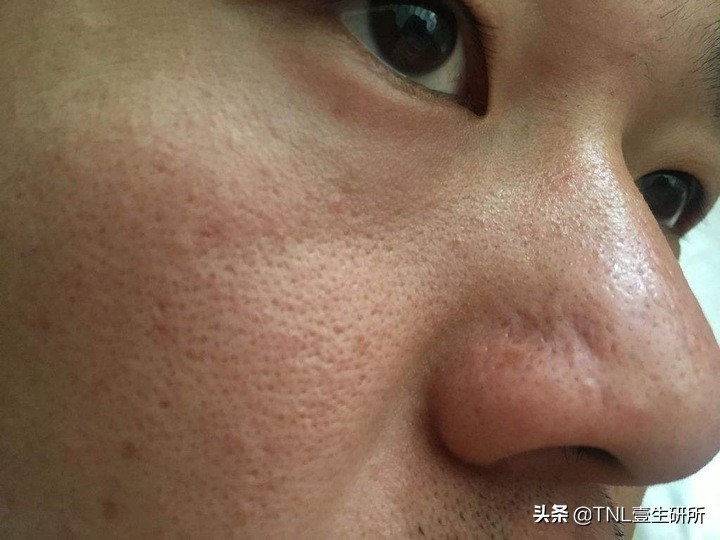 如何区分皂基洗面奶和氨基酸洗面奶？哪种更好用？