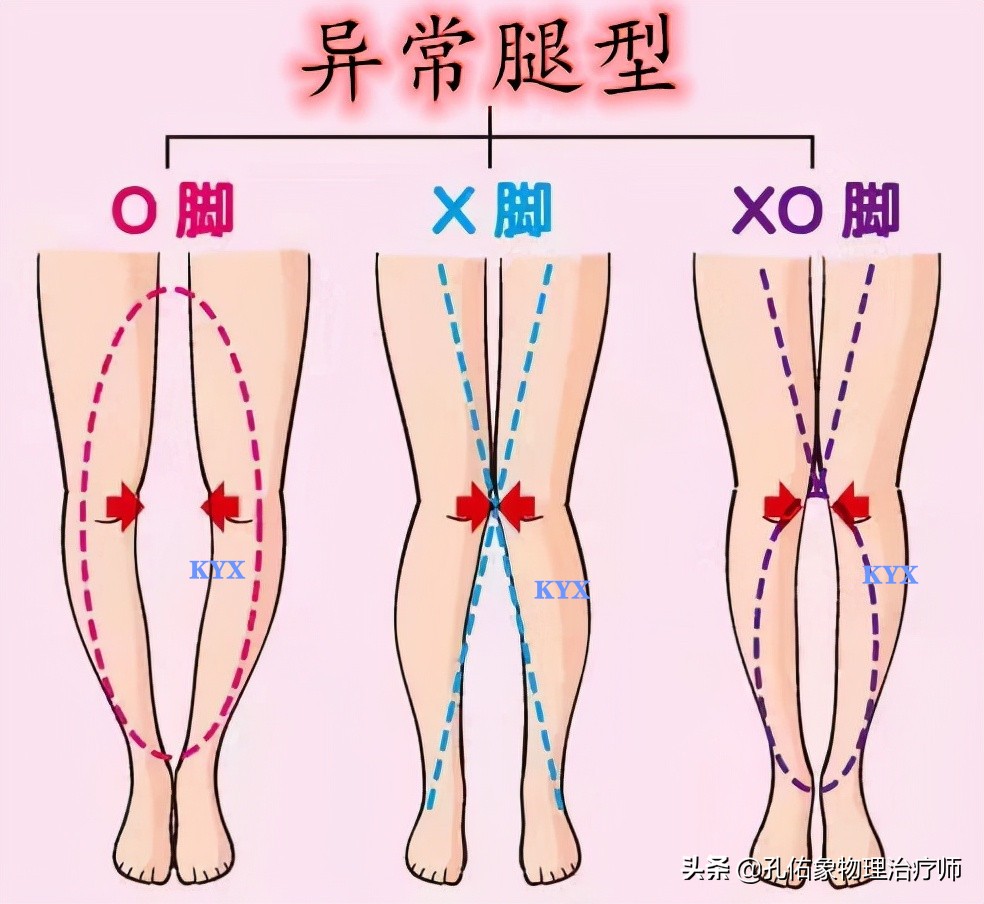 膝关节为什么疼痛？能治好吗？该如何应对呢？给您详细讲清楚