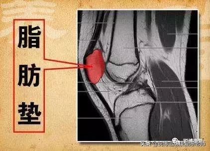 aj1刚穿上前面褶皱正常吗(AJ一穿就是褶？是什么毁了你的篮球鞋？)