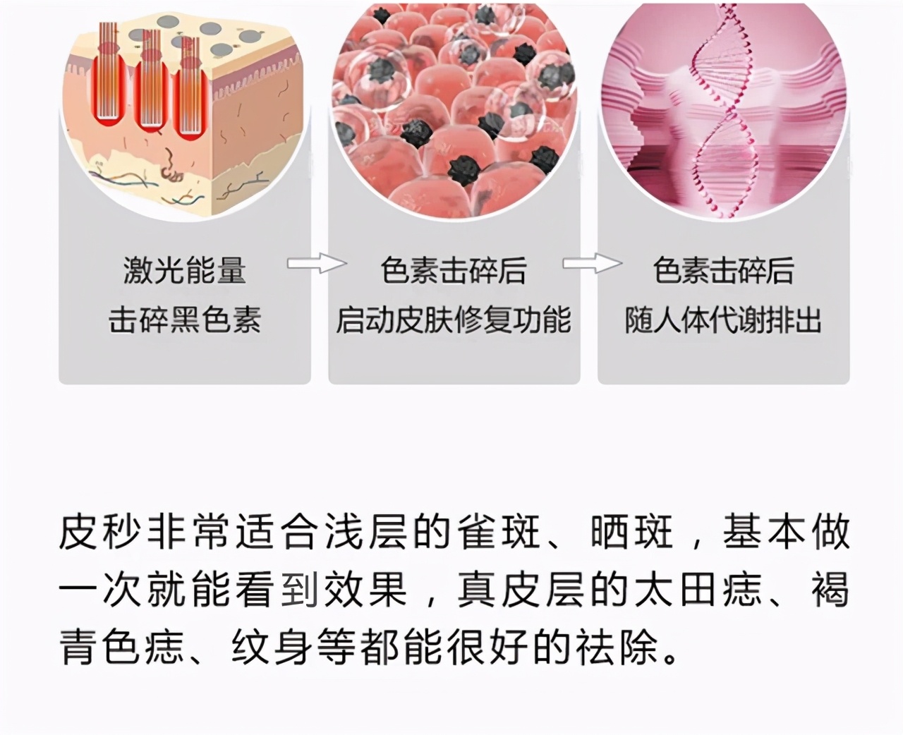 755蜂巢皮秒尖端美肤，演绎“纯白”至尊奢华