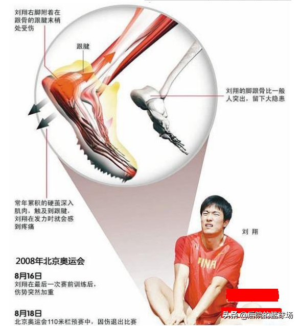 刘翔跟腱伤(揭秘刘翔伦敦奥运会为何带伤上阵跑到跟腱断裂，背后利益错综复杂)