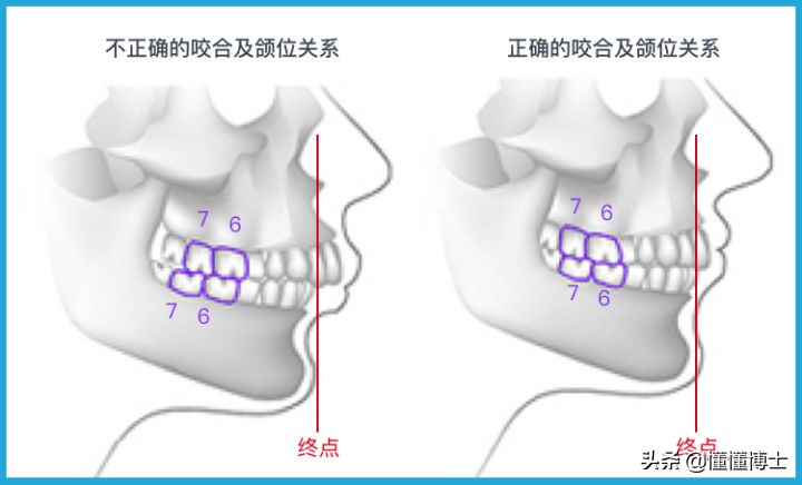 下巴后缩能带给你多大的颜值bug？下巴短和下巴后缩可不一样