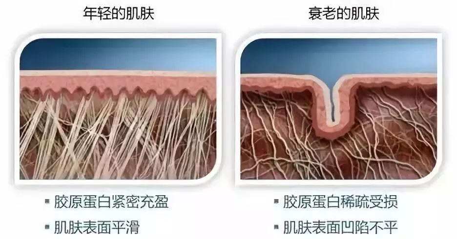 细纹干纹爬上脸，容颜开始衰老怎么办？