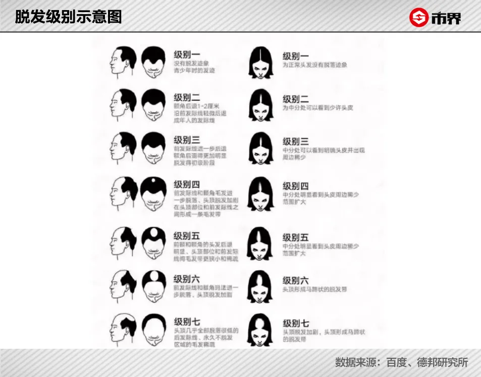 华晨宇被爆植发背后：中国有2.5亿人脱发，90后开始秃了