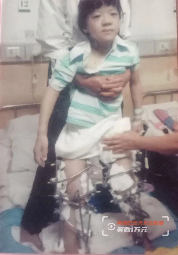 双腿畸形6年9次手术，女孩高考560分填报医学院：长大我想成为你