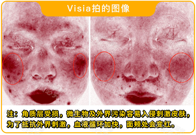 著名的毛孔收敛水，真的能隐形我的大毛孔吗？
