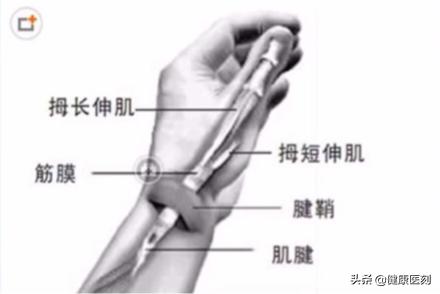 得了腱鞘炎，别急着手术！先试试这8个方法，大多数人都能缓解！