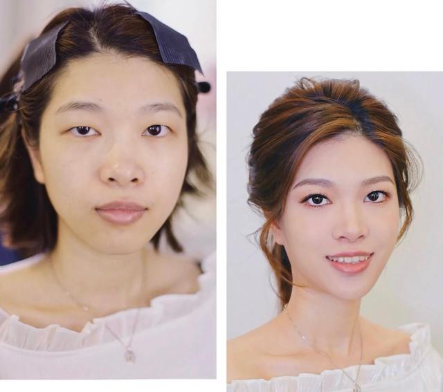 眼睛一大一小怎么办(大小眼)