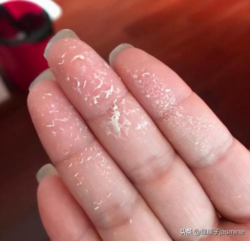 用护肤品总是出现搓泥现象，原因是护肤品质量太差吗？