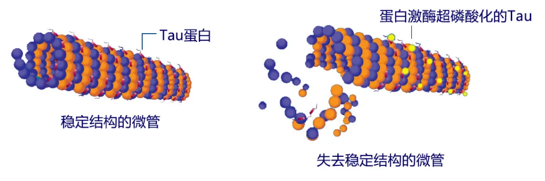 「直观明了」用图解释阿尔兹海默病的发病机制