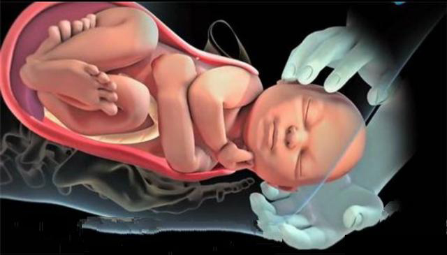 这个时候的疼痛还可以忍受,孕妇也尚能保持理智,正常的和医护人员沟通