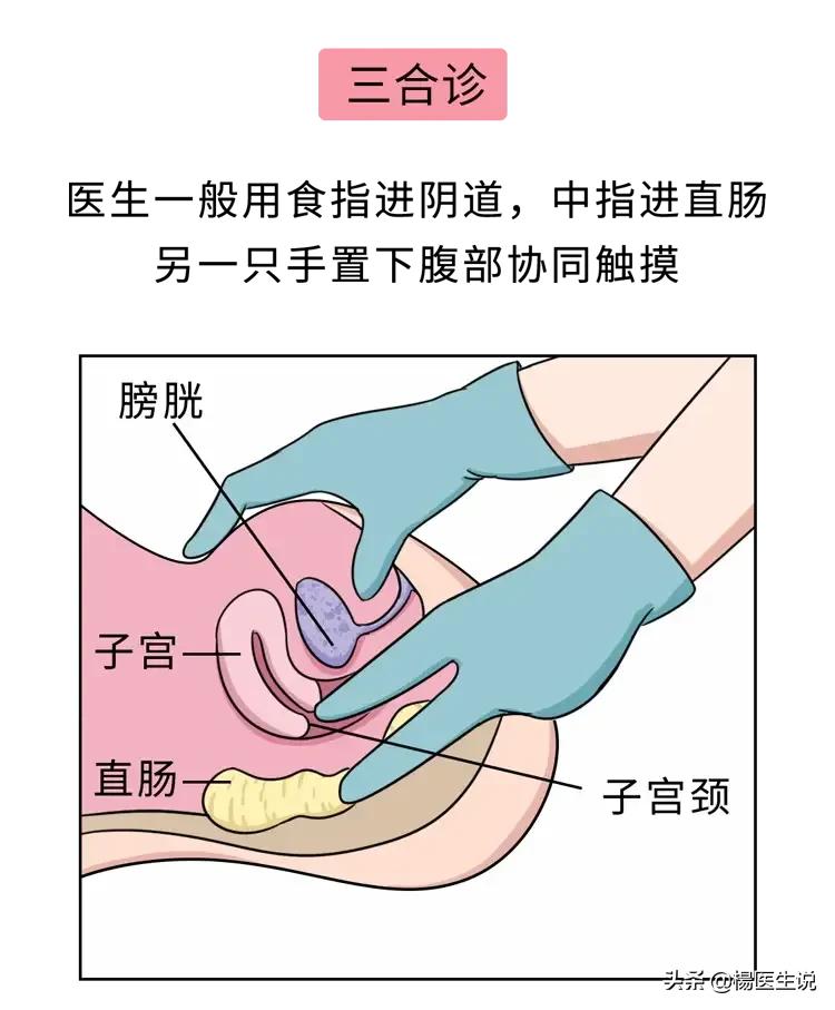 医院让人脸红的“妇科检查”，到底是如何进行的？一次性说清楚！