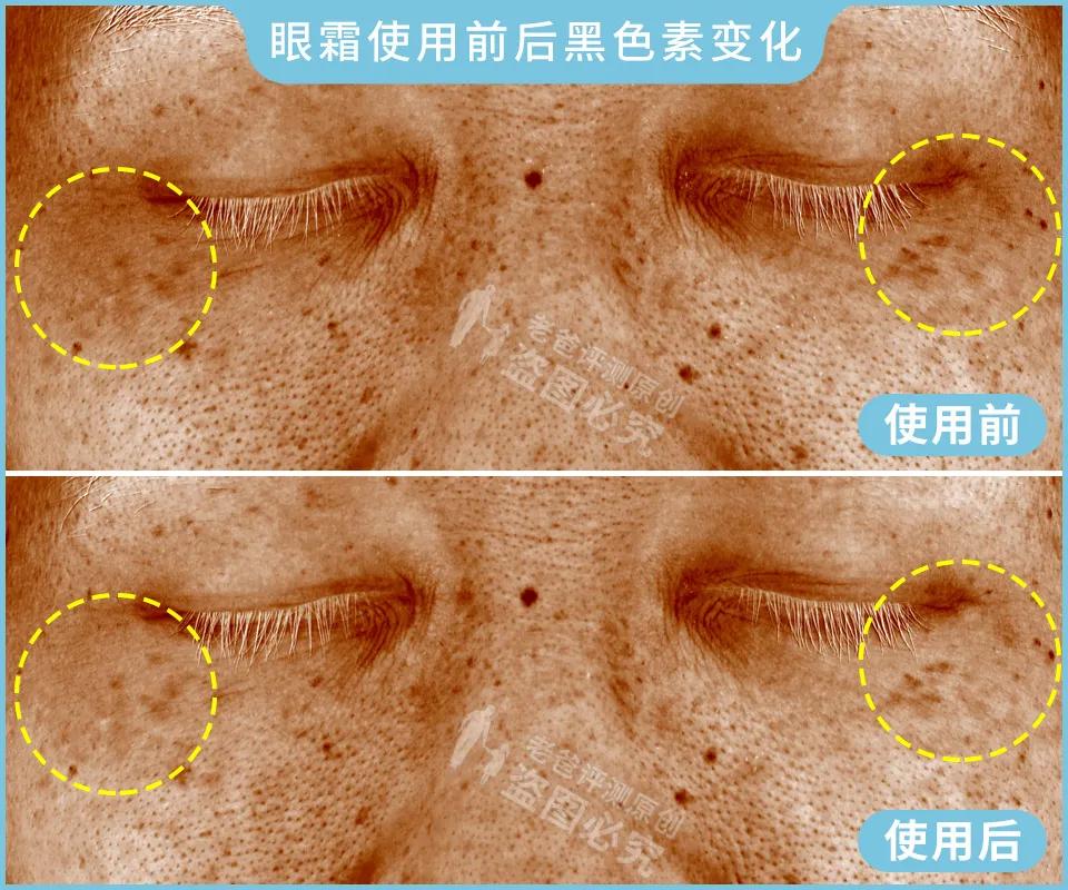 眼霜真的對黑眼圈、細紋有效嗎？1個月跟蹤實測結果來了
