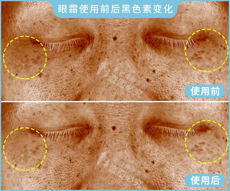 眼霜真的对黑眼圈、细纹有效吗？1个月跟踪实测结果来了