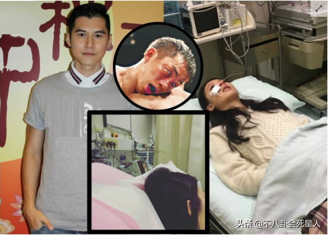 9位明星死里逃生,缝针,断肋骨,毁容,73岁老艺人白发送黑发