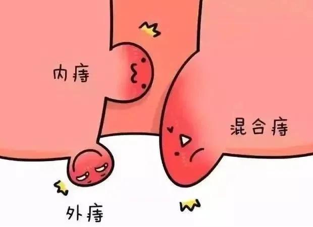 大便带血要小心！！除了痔疮，还可能是这种病