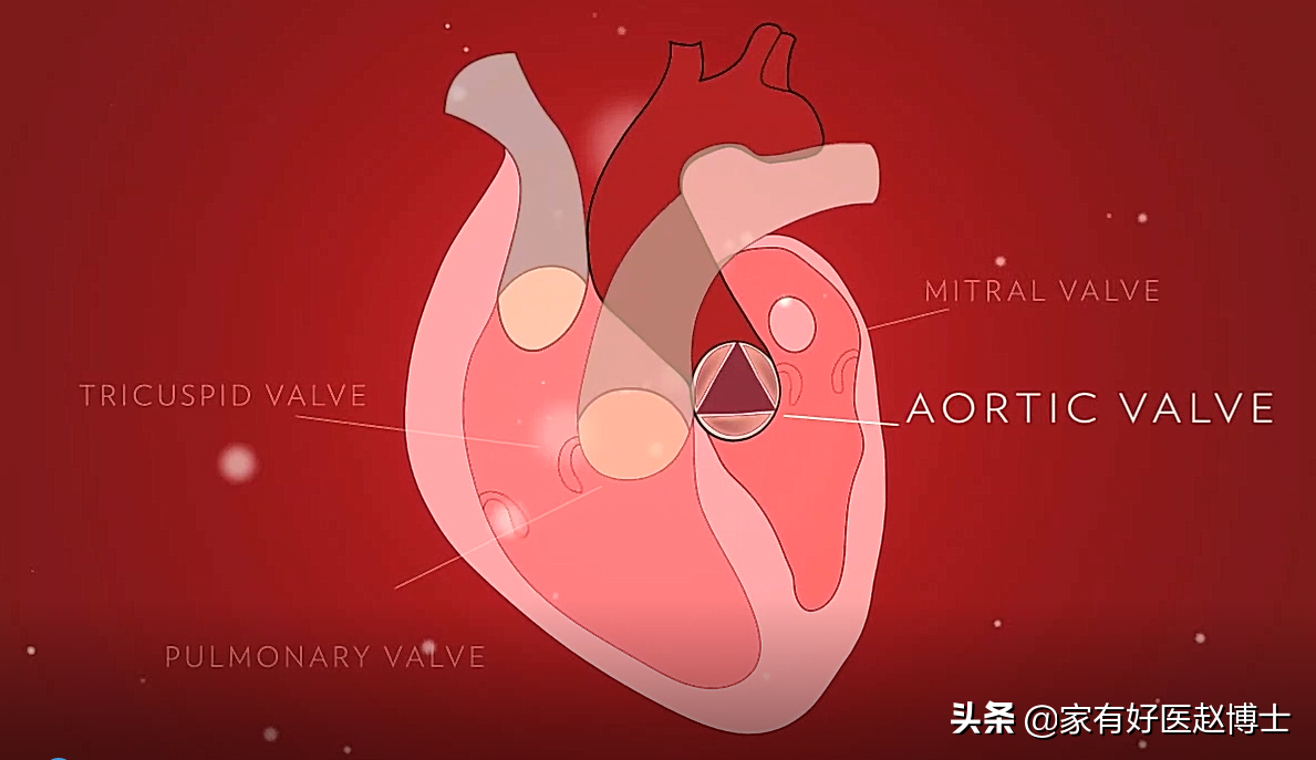脂蛋白a升高，究竟提示何种风险？“无药可治”，应该如何破解？