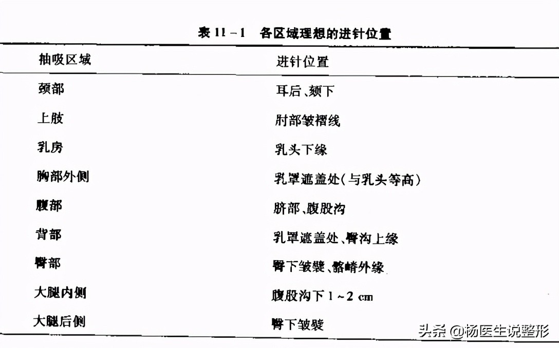 吸脂手术真的那么神奇吗？整形医生最推荐那种吸脂方式？