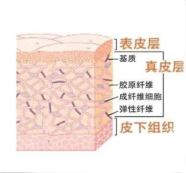 激光祛疤，你到底了解多少？帮你恶补一番！