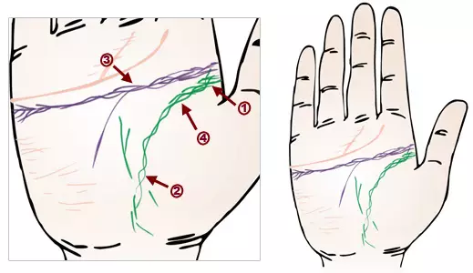 掌纹诊病：可以诊断肝癌、糖尿病、高血压、妇科病、脑溢血