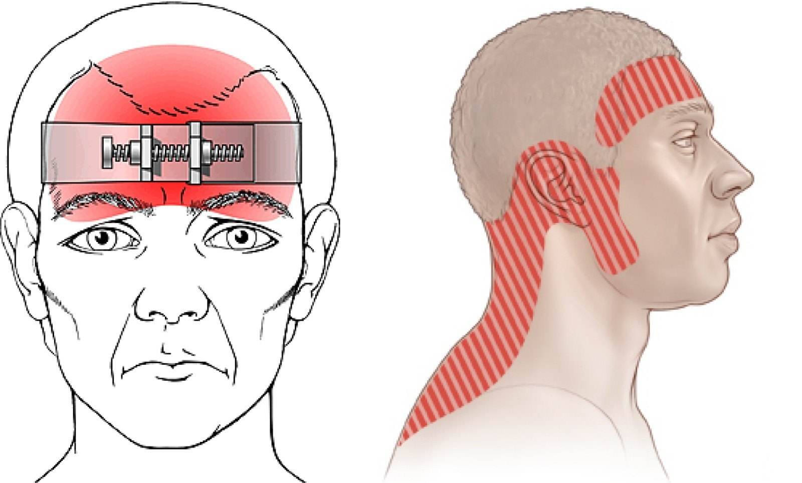 从解剖结构来看这个"脑瓜子疼"