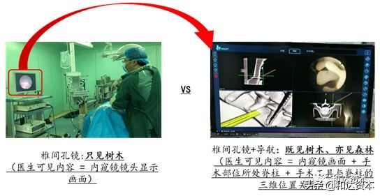 微创骨科医疗器械初步分析