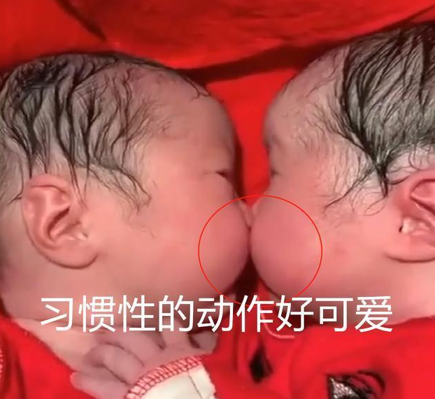 龙凤胎出生20分钟，妹妹就夺走哥哥“初吻”，网友：画面太暖心
