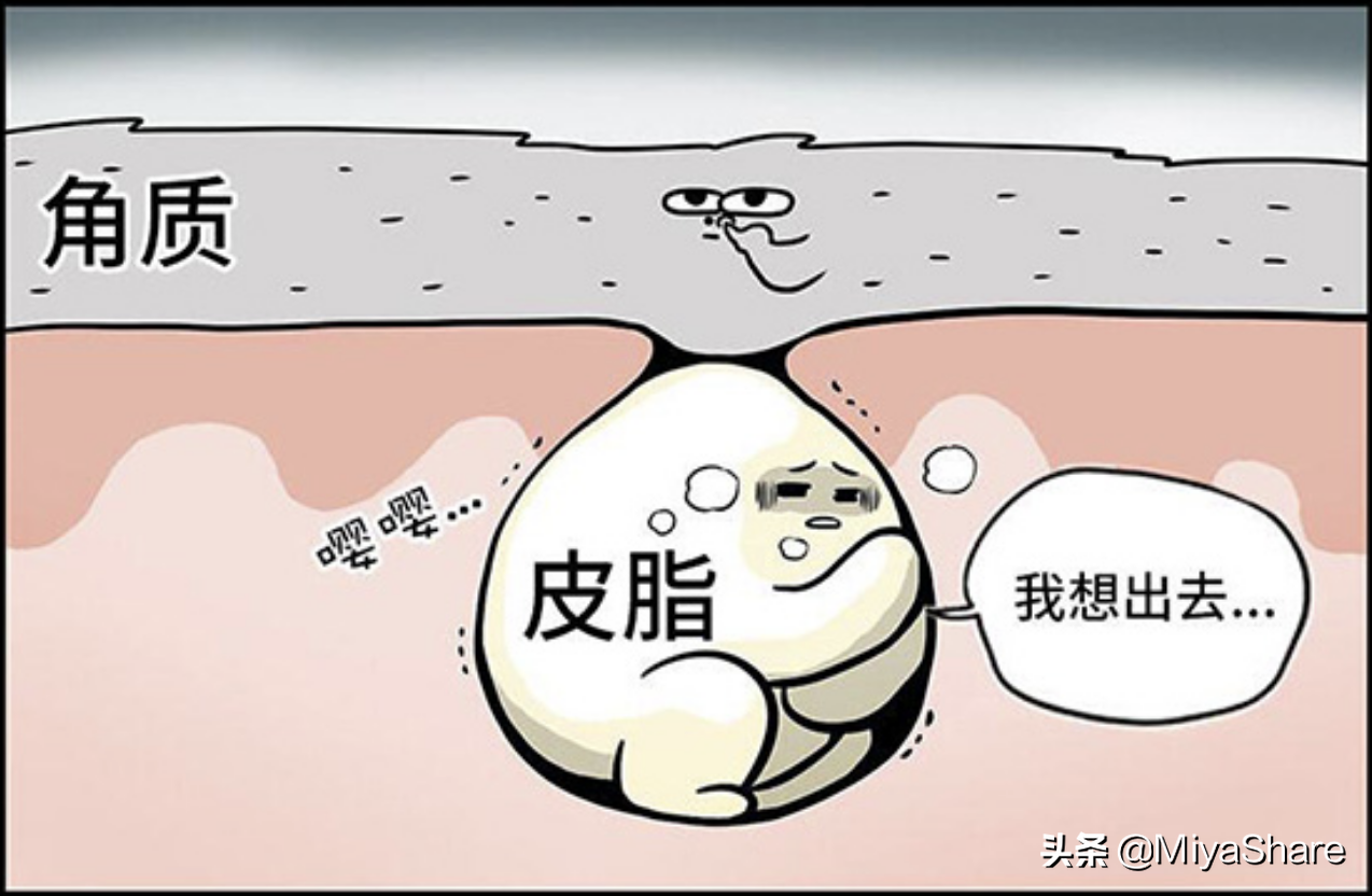 8款平價祛痘產品推薦，都是大牌很好用，學生黨必看