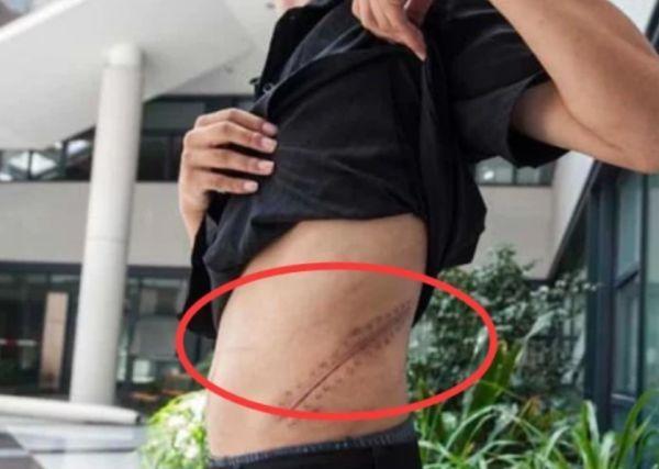 8年过去了，当年为买苹果手机不惜卖肾的男孩，如今怎么样了