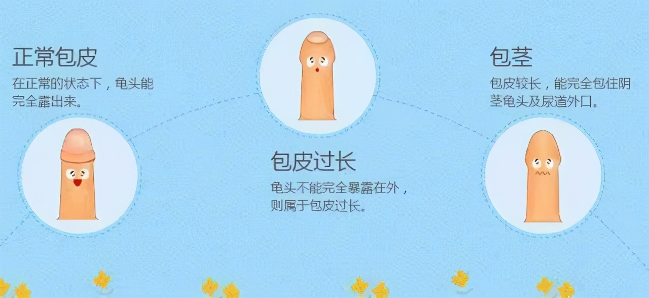 割包皮竟成了“妈妈病”，不割真会影响发育吗？看看医生怎么说