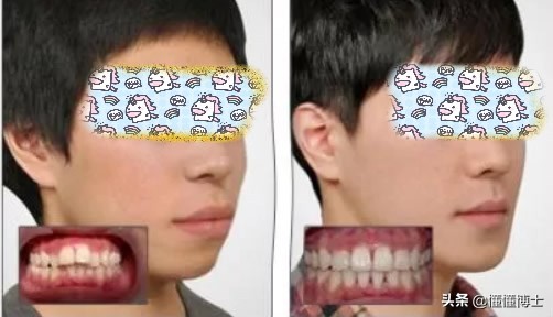 同样是凸嘴，为什么这些女明星就这么漂亮？两招教你摆脱土气脸