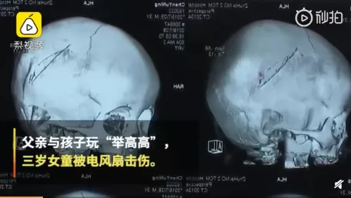 6类亲子游戏被列入“黑名单”！孩子越喜欢，家长越要拒绝