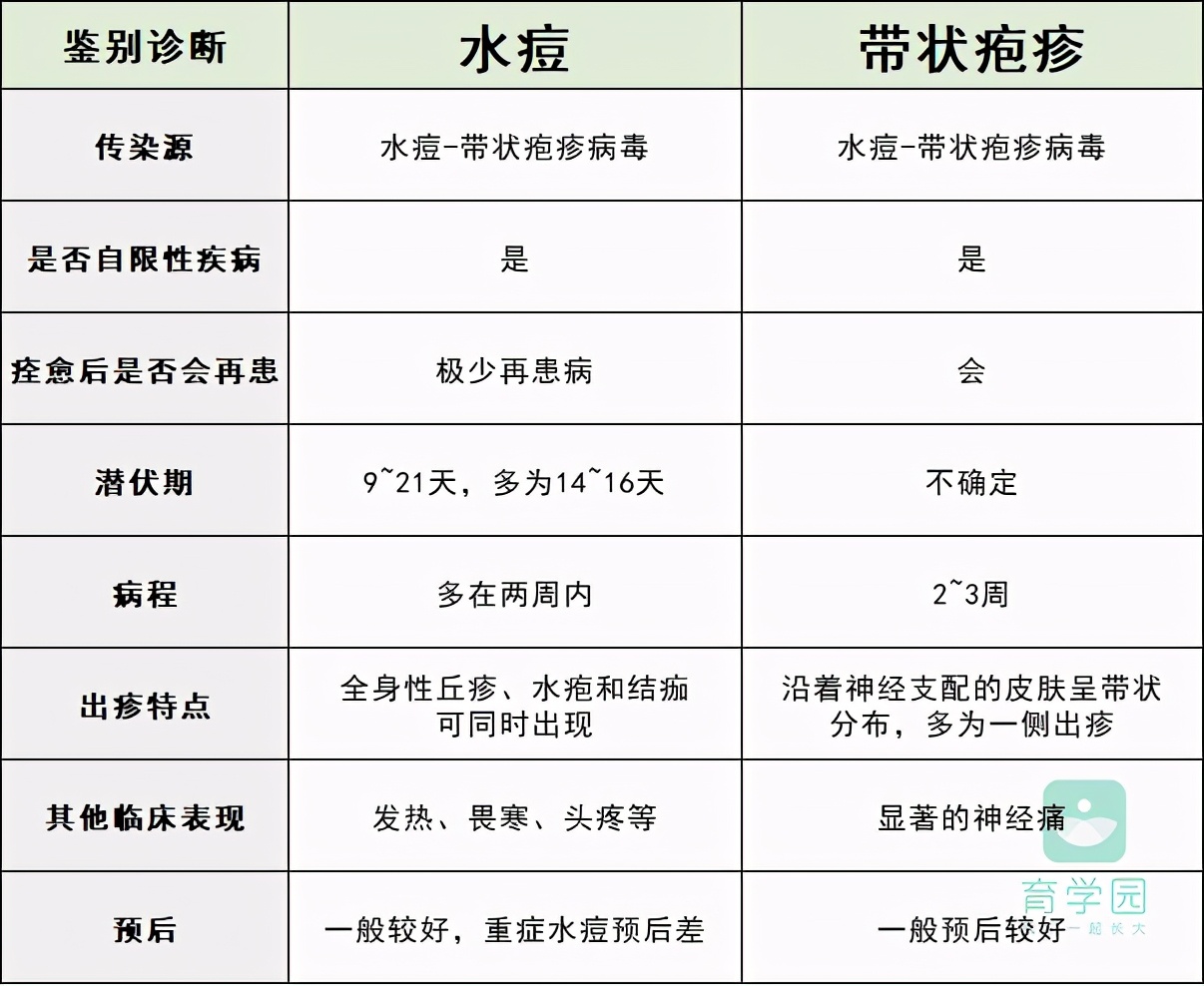 水痘初期症状图片 水痘怎么治疗好得快-大连号