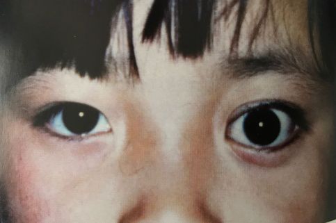 4个月婴儿倒睫毛怎么办(婴幼儿眼睛要注意什么) - 乐宝宝贝