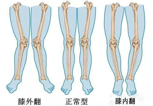 小学生踢足球会不会o型腿(为什么我孩子的腿不直呢？怎么办呢)