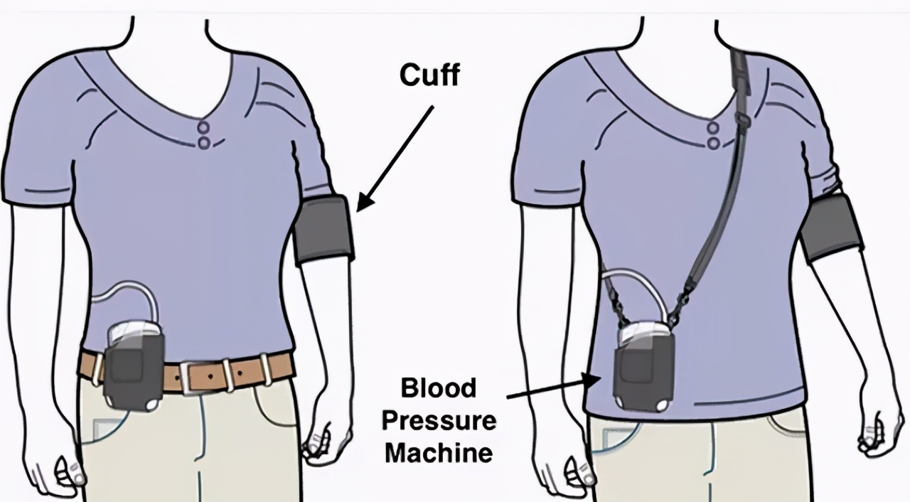血压动态监测，多数高血压患者都应做一下，有四个重要作用