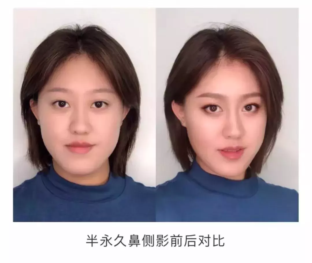 最漂亮的3种鼻子,第1种很少有人有
