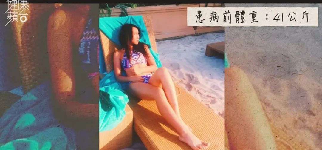 00后英国留学患病暴肥19kg，停止减肥才是出路？