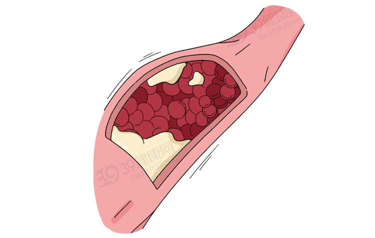想锻炼成肌肉男，每天至少要吃多少蛋白质？一个公式简单算一算