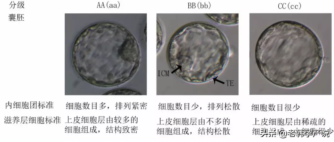 试管婴儿成功率高的医生，这样评估胚胎等级