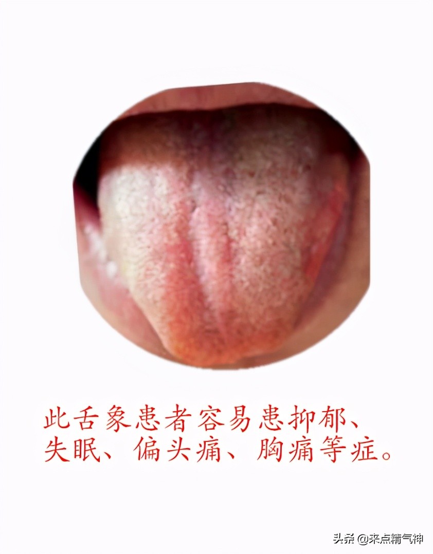 舌头胖大，还有红点点怎么回事，听听专家怎么说