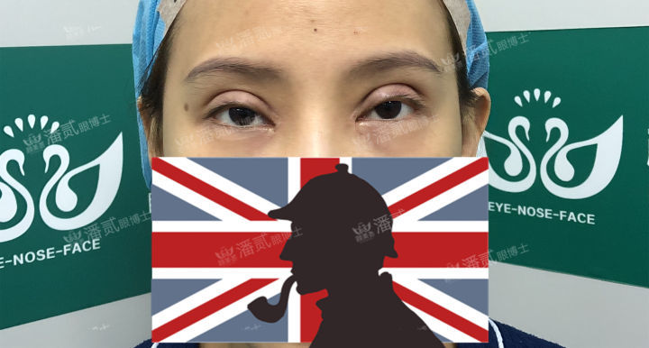 韩式三点双眼皮可以维持几年(一场失败的双眼皮手术，使19岁少女容貌畸形，生活停顿，恳求急救)