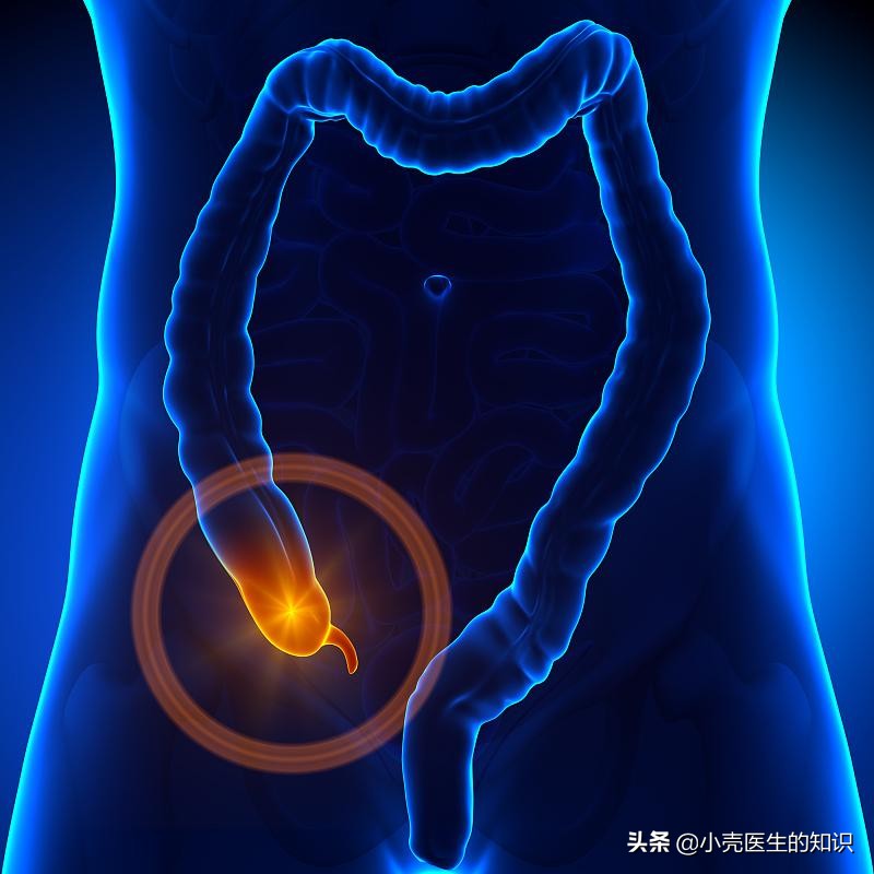 阑尾炎位置在哪边(阑尾炎是哪边痛哪个位置)-友友