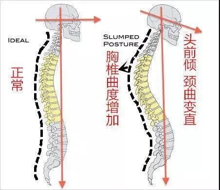 泰国技师招聘网（拯救低头族）